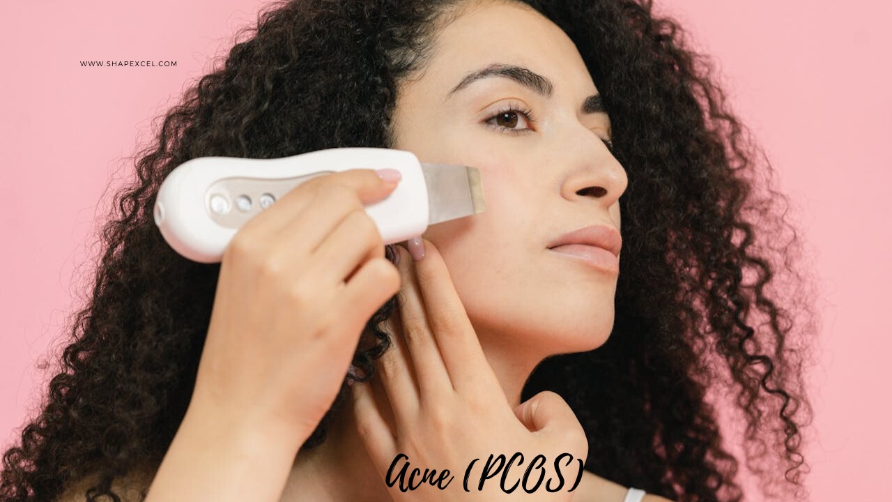 pcos-pcod-causes-skin-changes-and-acne