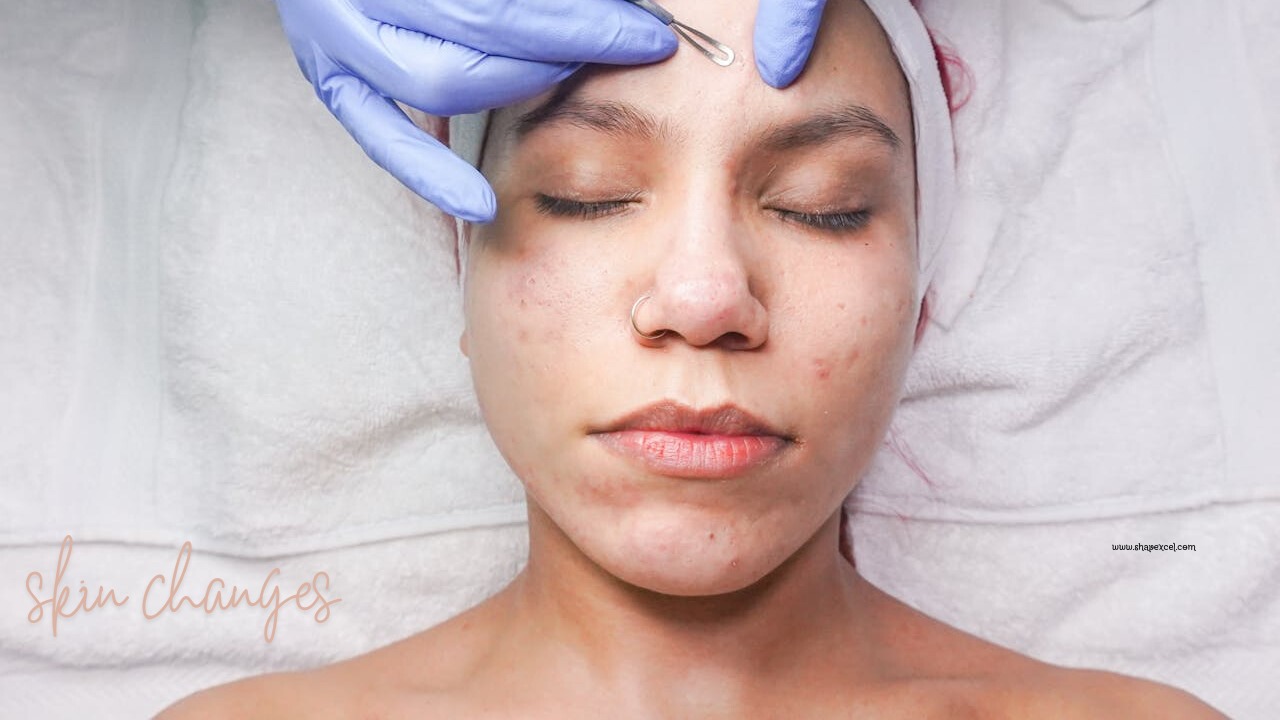 skin-changes-caused-by-pcos-or-pcod